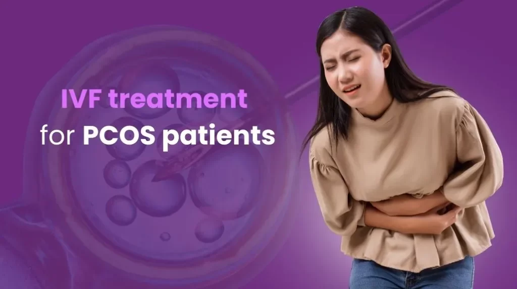 IVF treatment for PCOS patients