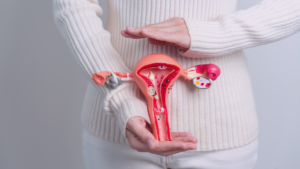 PCOS Is Now Being Called PMOS