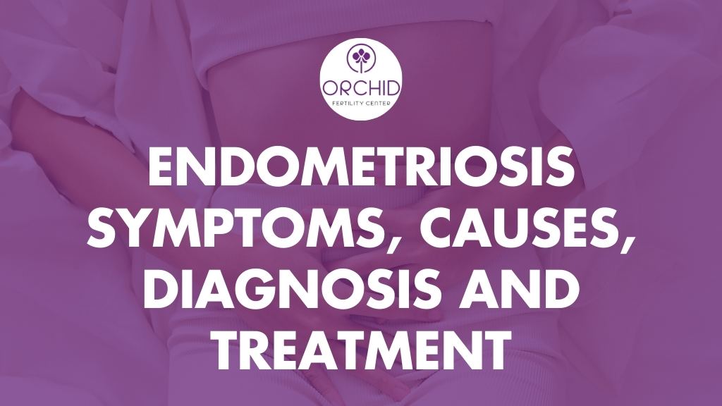 Endometriosis Symptoms, Causes, Diagnosis and Treatment